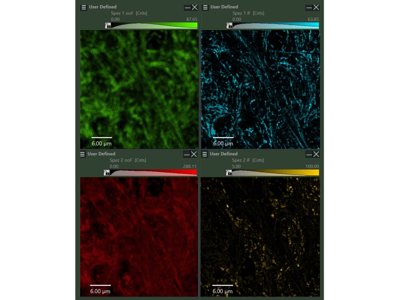 Computational Sectioning: Separating in-focus and out-of-focus signal components for improved image clarity and lifetime species separation.