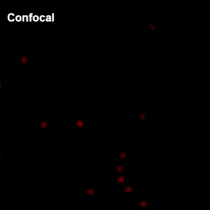 Confocal fluorescence image at 640 nm excitation. Limited resolution results in blurred and overlapping signal spots.