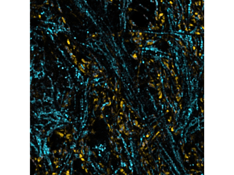 Refined ISM-FLIM Image: Enhanced resolution and contrast after computational sectioning and lifetime species separation.