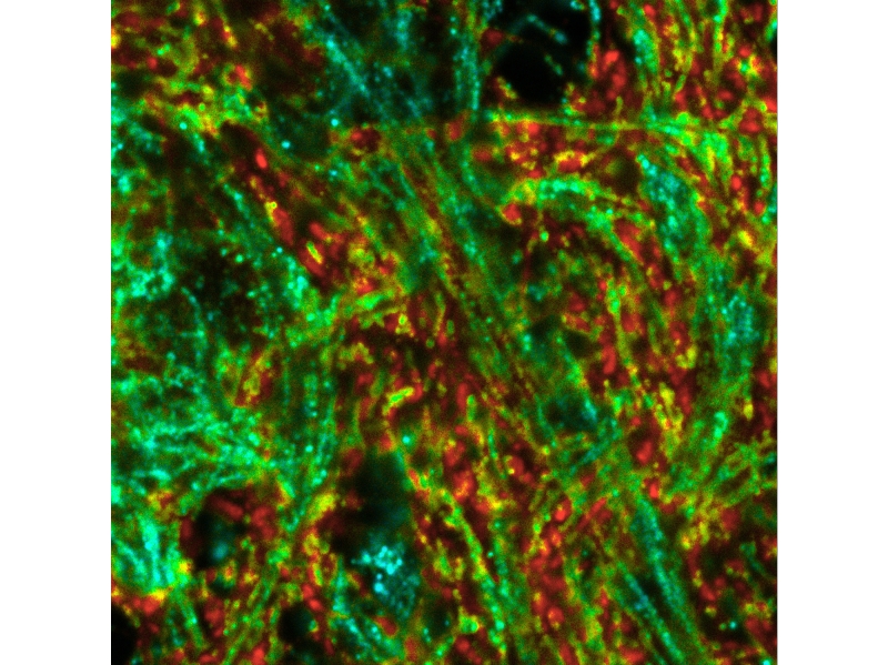 Standard fluorescence image